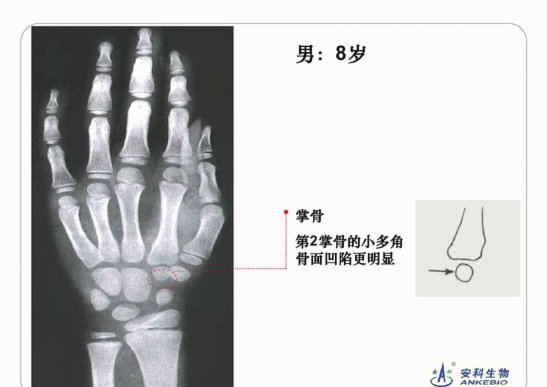 让小黑测骨龄不是董路先说然后宝库跟进的吗
